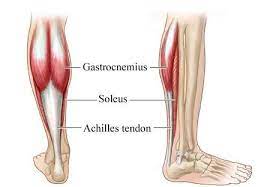 Muscle injuries of the gastrocnemius and soleus